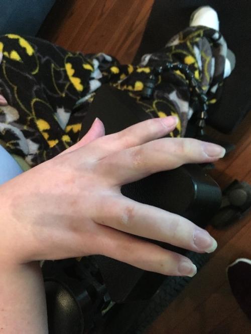 Ryan's hand on the Micro Joystick in the hand pad